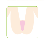 Ⅰライン脱毛の口コミ（クチコミ）情報の商品写真