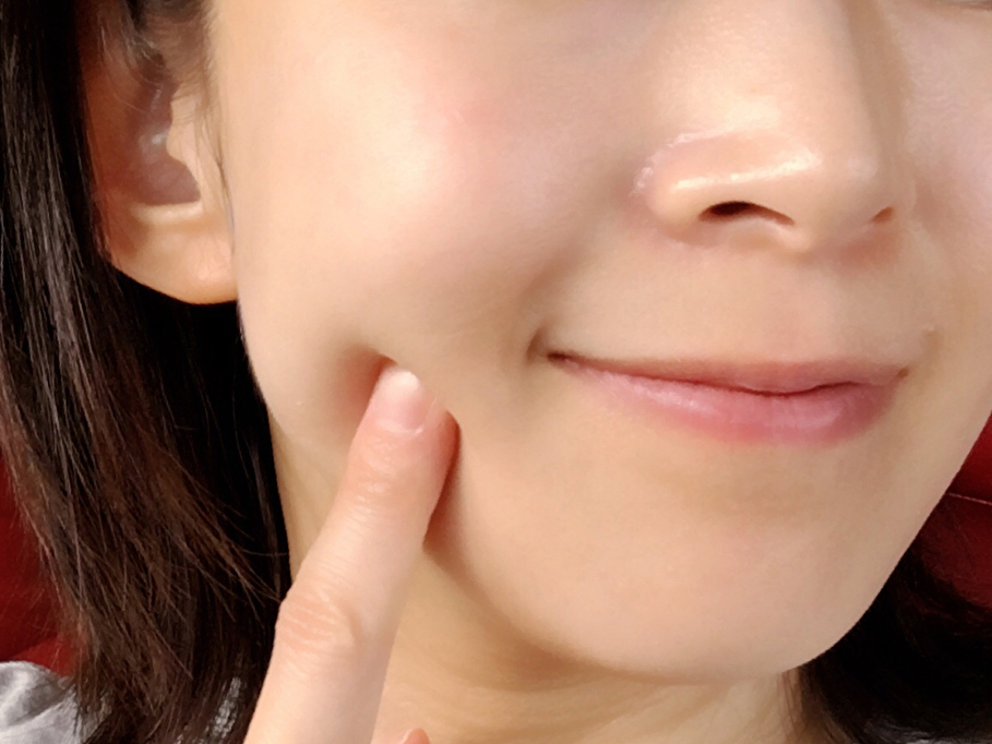 透明感を取り戻したいなら 肌の漂白剤 と呼ばれる成分 ハイドロキノン 配合のドクターズコスメを My Trend Site