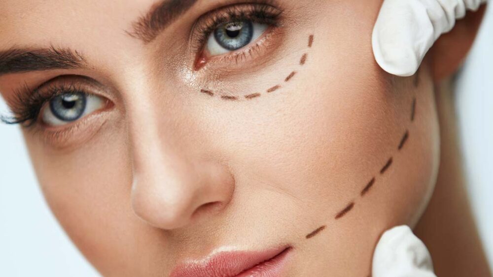 美容整形　英語　plastic surgery