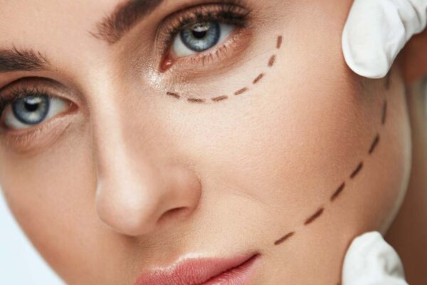 美容整形　英語　plastic surgery