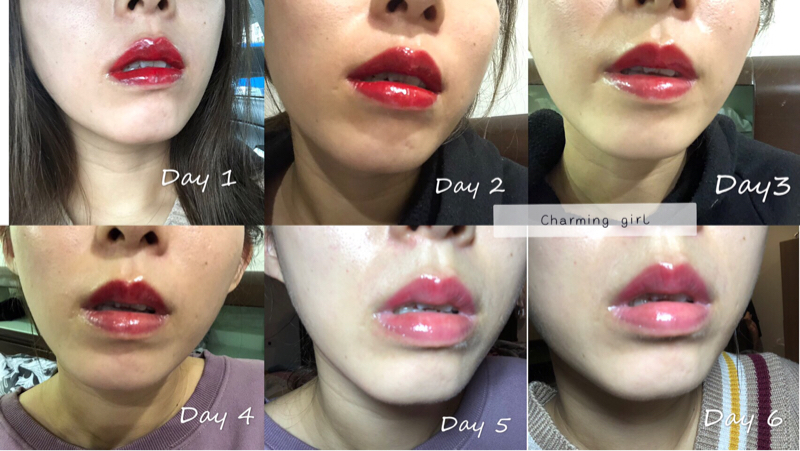 喬米時尚美學-行天宮店 - 粉嫩唇修復過程