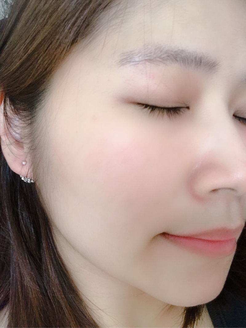 林安琪 - 這是我現在的膚況

全靠自己保養，無做任何醫美，難免會有粉刺，但整體狀況是在可掌握內。