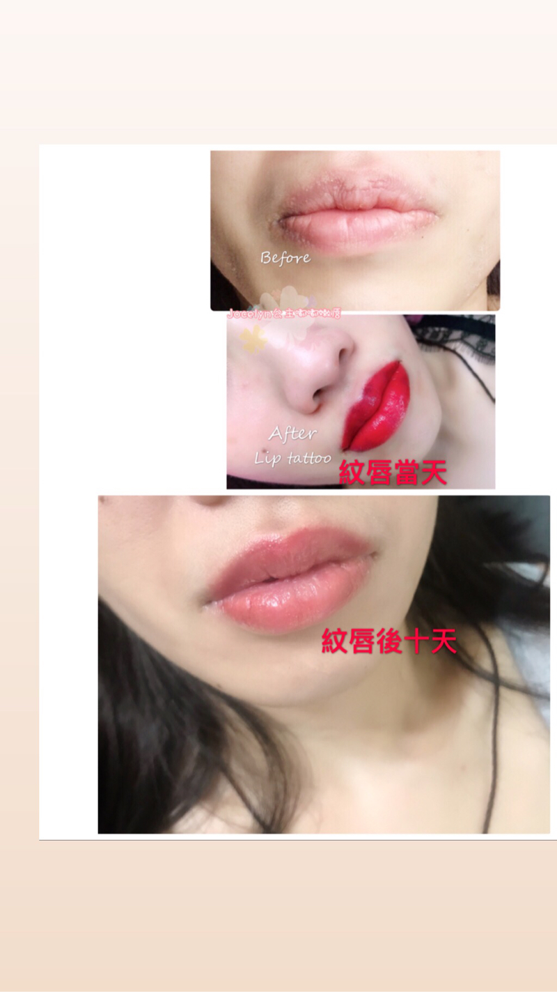 蘇蕎鈴 - 公主嫩唇
#改唇色
暗沉唇
原價10000
優惠價8000
無血色唇
黑唇
#調整唇型比例更完美