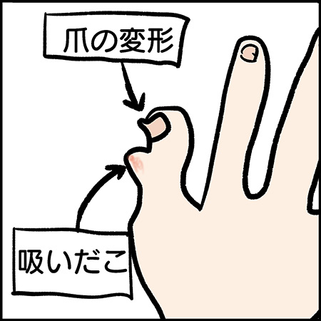 双子漫画117-3