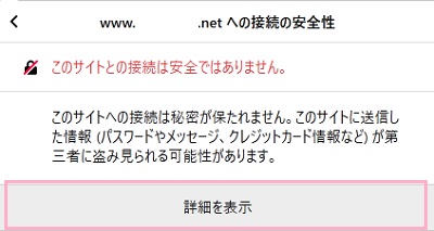「このサイトとの接続は安全ではありません。」画面の「詳細を表示」をクリック