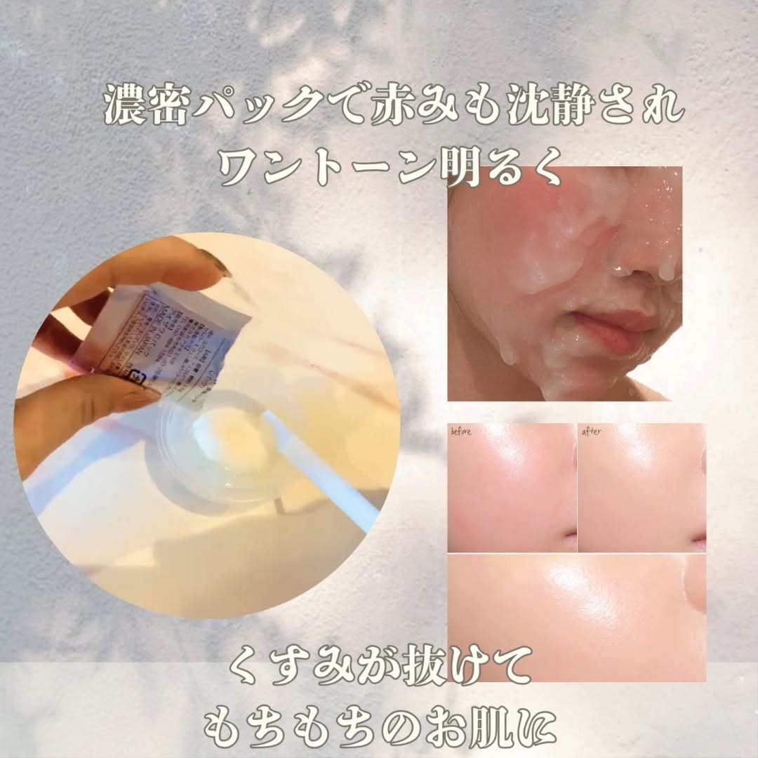 アクネスラボ　炭酸パック 楽天市場】アクネスラボ 相澤メソッド 炭酸パック 【公式】HIN