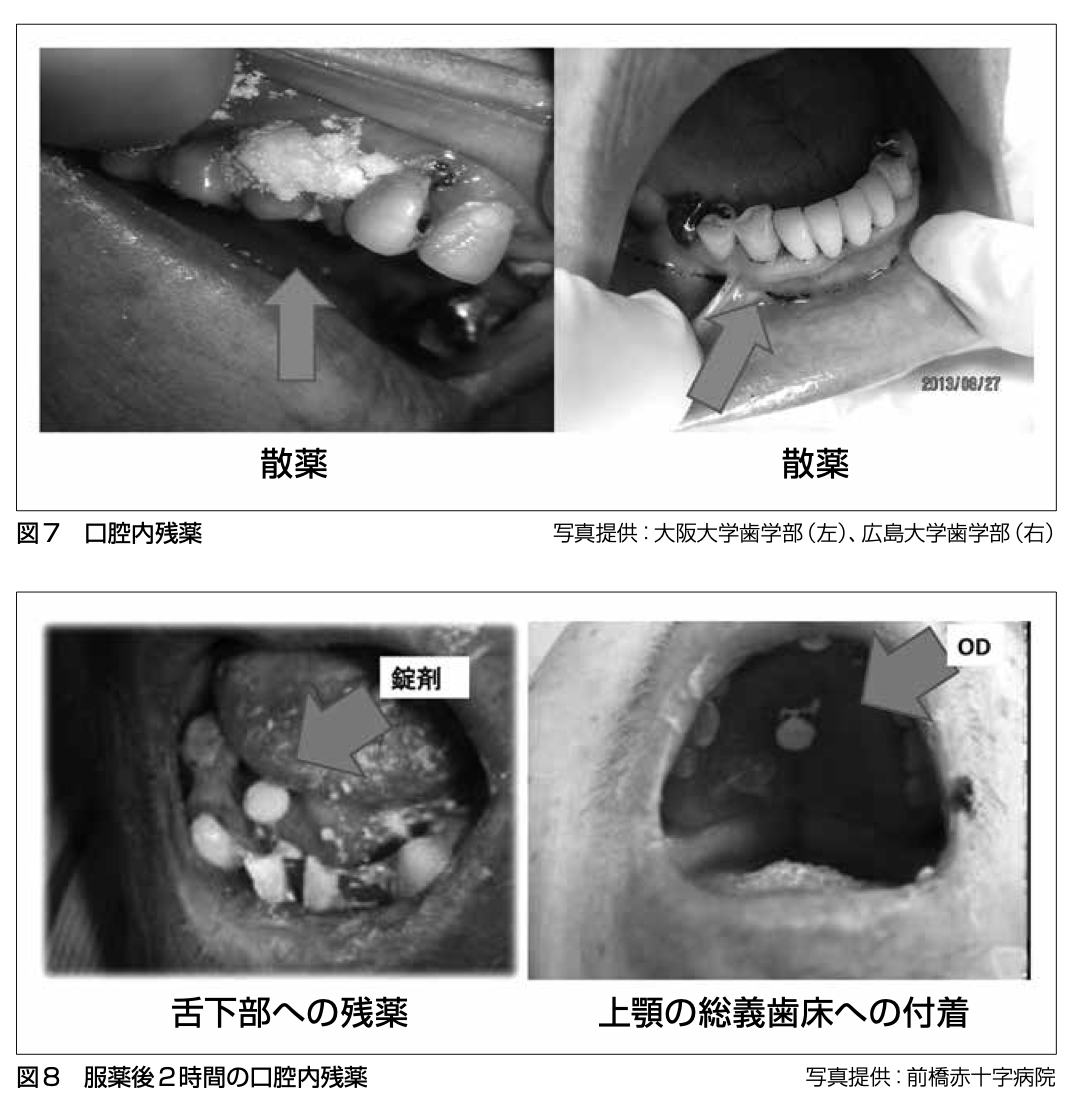 野﨑園子：「薬剤と嚥下障害」、日本静脈経腸栄養学会雑誌 31（2）：699-704：2016