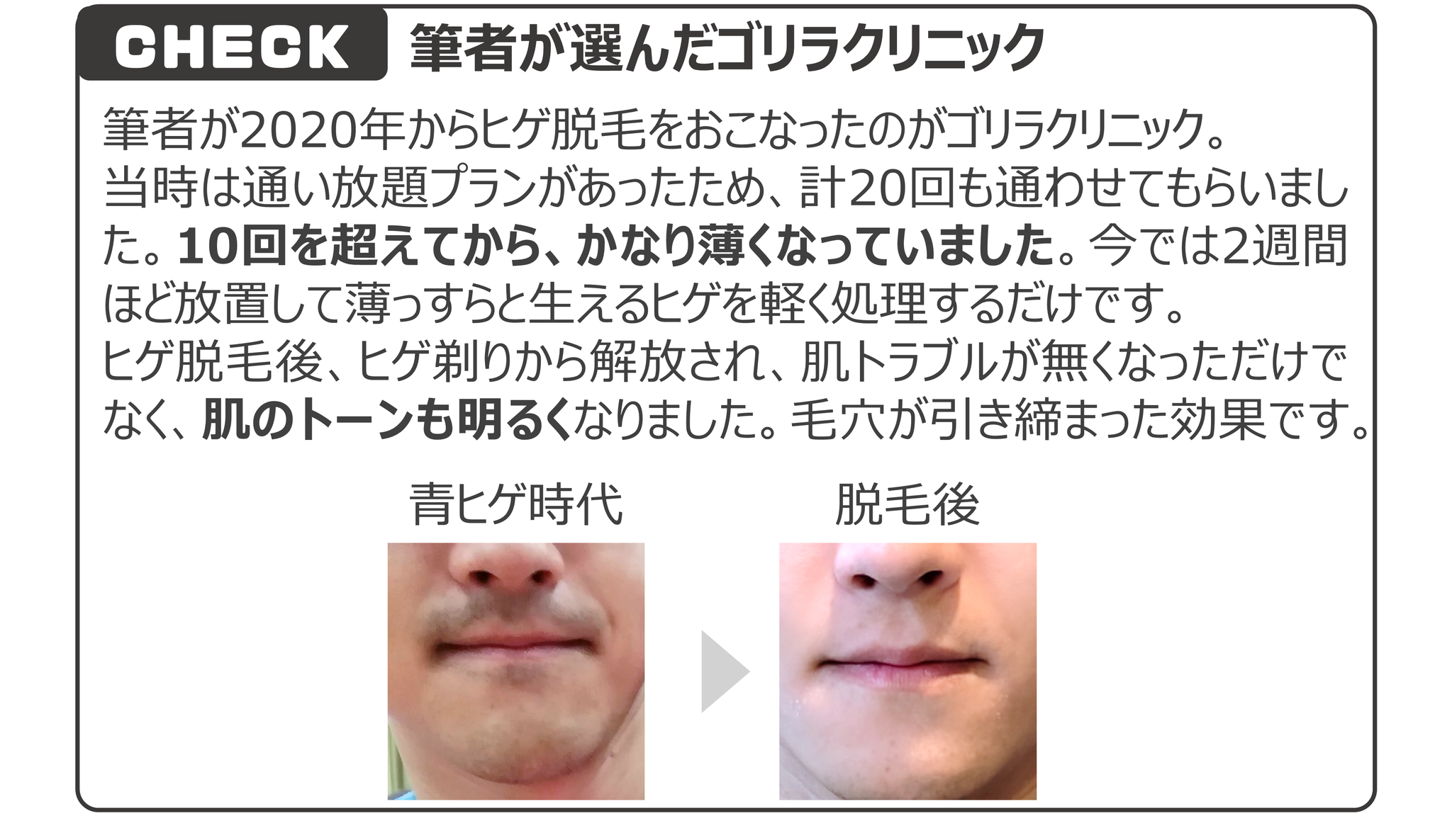 筆者手術したゴリラクリニック
