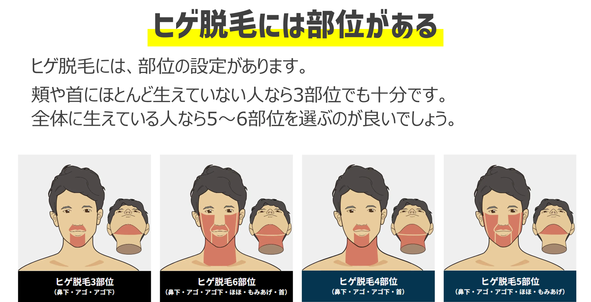 ヒゲ脱毛の部位